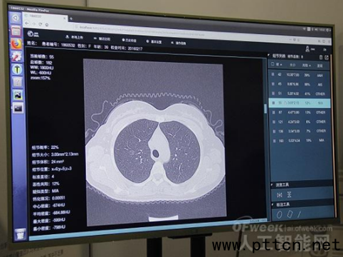 (lin)W(wng)oa(chn)I(y)޴CI(lng)󌢱q4